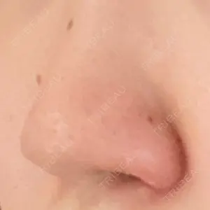 GLANZ CLINIC口コミ