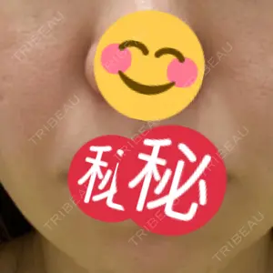 聖心美容クリニック グループ 聖心美容クリニック 六本木院口コミ