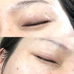 AI Beauty Clinic （エーアイ美容クリニック）口コミ