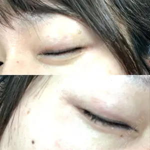 AI Beauty Clinic （エーアイ美容クリニック）口コミ