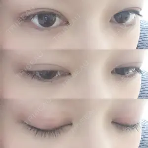共立美容外科・歯科 共立美容外科 渋谷院口コミ