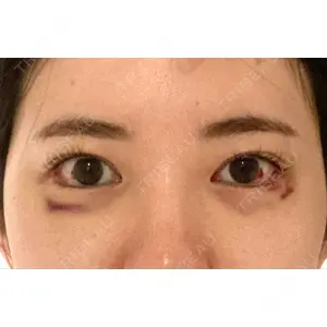 POP美容整形クリニック口コミ