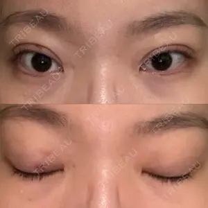 AI Beauty Clinic （エーアイ美容クリニック）口コミ