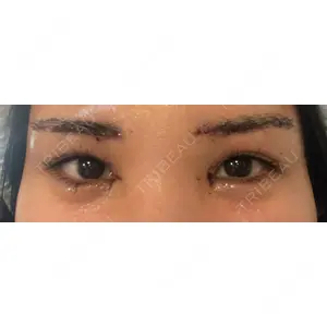 湘南美容クリニック 湘南美容クリニック 自由が丘院口コミ