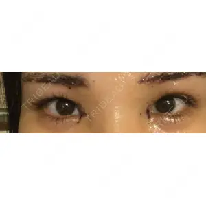 湘南美容クリニック 湘南美容クリニック 自由が丘院口コミ