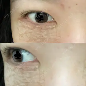 お茶の水美容形成クリニック 吉井クリニック口コミ