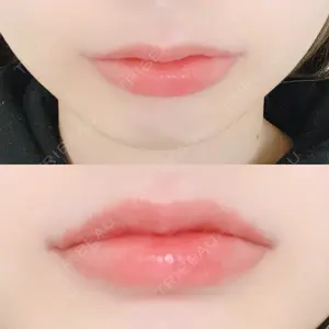 B-LINE CLINIC B-LINE CLINIC 池袋院口コミ