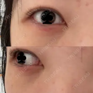 お茶の水美容形成クリニック 吉井クリニック口コミ