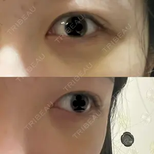 お茶の水美容形成クリニック 吉井クリニック口コミ