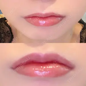 B-LINE CLINIC B-LINE CLINIC 池袋院口コミ