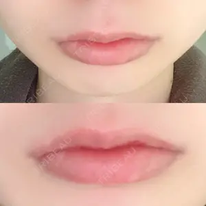 B-LINE CLINIC B-LINE CLINIC 池袋院口コミ