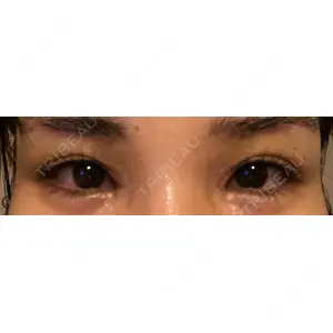 湘南美容クリニック 湘南美容クリニック 自由が丘院口コミ