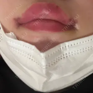 口コミ