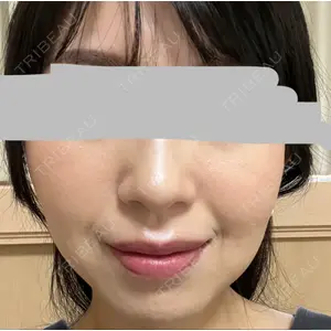 プラチナクリニック口コミ