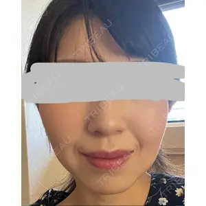 プラチナクリニック口コミ