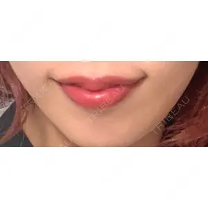 BELINDA CLINIC BELINDA CLINIC（ベリンダクリニック）新宿院口コミ