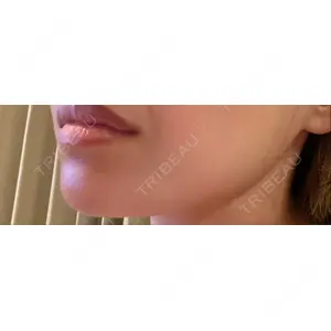 TCB東京中央美容外科 TCB東京中央美容外科 静岡院口コミ