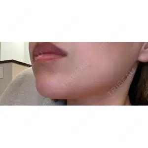 TCB東京中央美容外科 TCB東京中央美容外科 静岡院口コミ