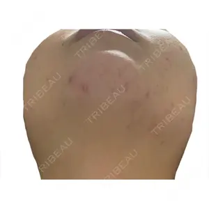 KMクリニック KM新宿クリニック口コミ