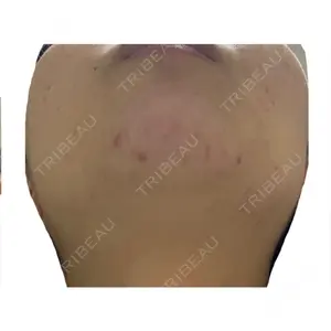 KMクリニック KM新宿クリニック口コミ