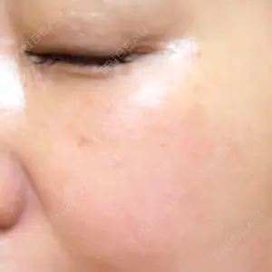 ももスキンケアクリニック口コミ