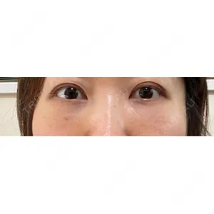 X CLINIC X CLINIC 銀座院口コミ