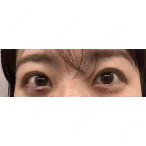 TCB東京中央美容外科 TCB東京中央美容外科 心斎橋院口コミ