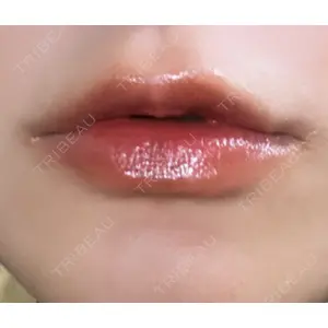 Mavie Beauty Clinic （マヴィービューティークリニック）口コミ