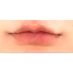 Mavie Beauty Clinic （マヴィービューティークリニック）口コミ