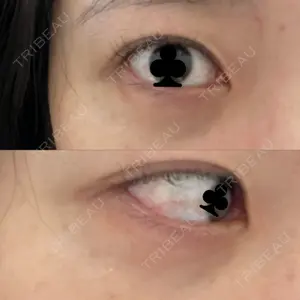 お茶の水美容形成クリニック 吉井クリニック口コミ