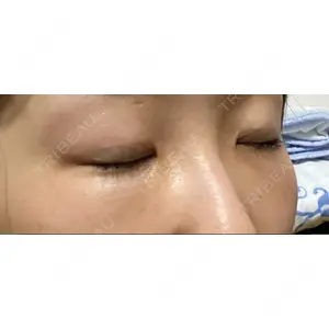 X CLINIC X CLINIC 銀座院口コミ