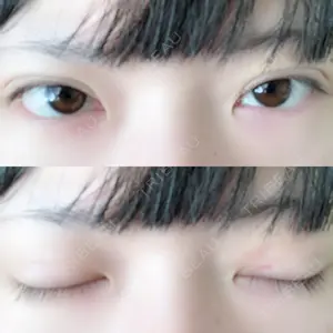口コミ