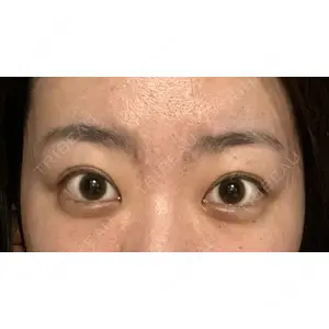 TCB東京中央美容外科 TCB東京中央美容外科 心斎橋院口コミ
