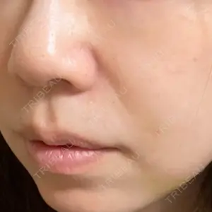 AI Beauty Clinic （エーアイ美容クリニック）口コミ