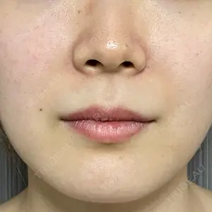 L‘amour clinic Tokyo【ラムールクリニック東京】口コミ