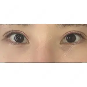 X CLINIC X CLINIC 銀座院口コミ