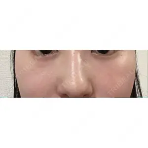 X CLINIC X CLINIC 銀座院口コミ
