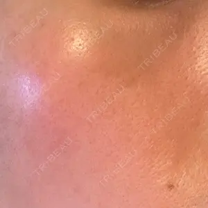エルムクリニック 美容皮膚科エルムクリニック 広島院口コミ
