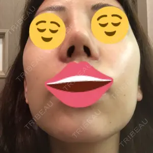 口コミ