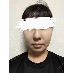 口コミ