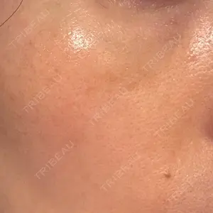 エルムクリニック 美容皮膚科エルムクリニック 広島院口コミ