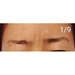 湘南美容クリニック 湘南美容クリニック 宇都宮院口コミ