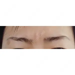 湘南美容クリニック 湘南美容クリニック 宇都宮院口コミ