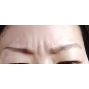 湘南美容クリニック 湘南美容クリニック 宇都宮院口コミ