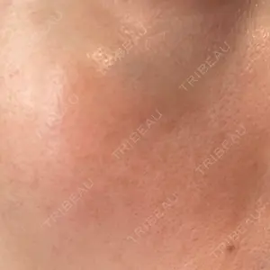 エルムクリニック 美容皮膚科エルムクリニック 広島院口コミ