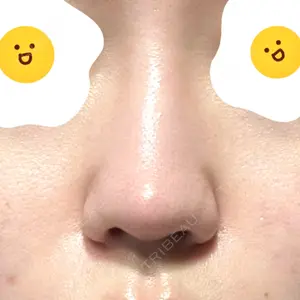 口コミ