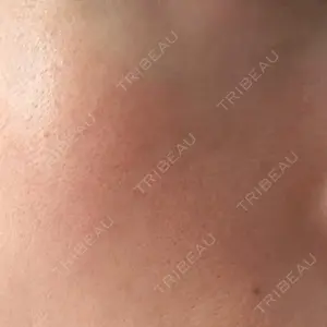 エルムクリニック 美容皮膚科エルムクリニック 広島院口コミ