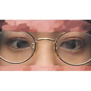 東京イセアクリニック口コミ