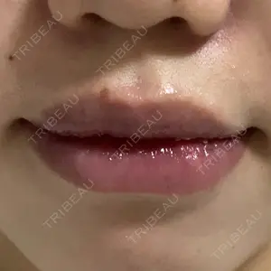 B-LINE CLINIC B-LINE CLINIC 池袋院口コミ