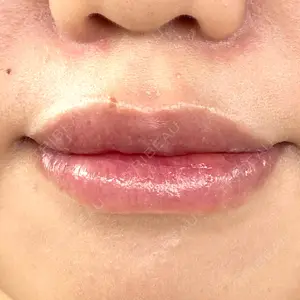 B-LINE CLINIC B-LINE CLINIC 池袋院口コミ